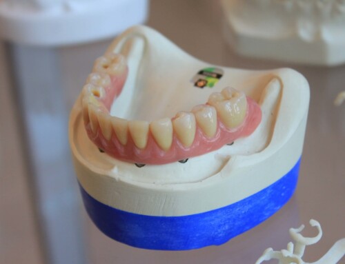 Adult Tooth Decay & Your Options