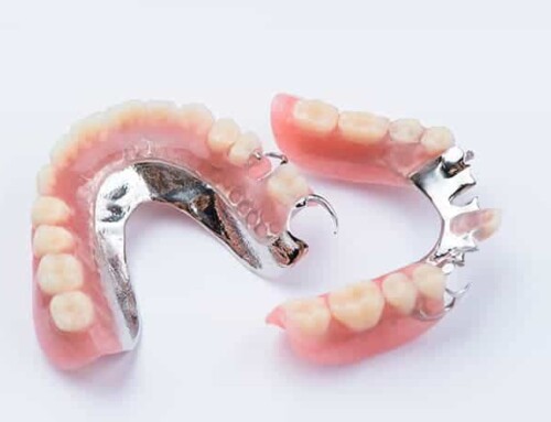 Dentures: Types and Cost of Partial Dentures