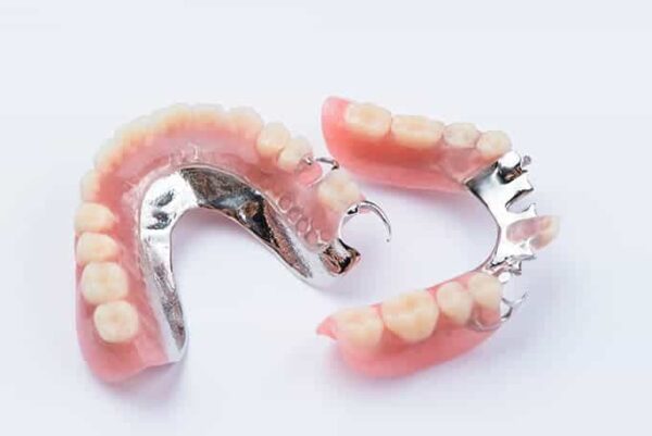 Types and Cost of Partial Dentures | District Dentistry Charlotte