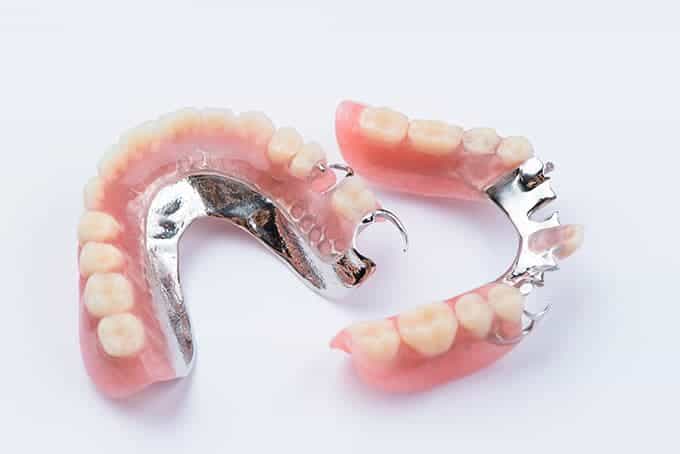 Types and Cost of Partial Dentures - District Dentistry