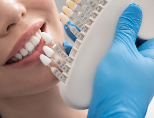 6 Important Facts That Explains The Importance Of Dental Crowns