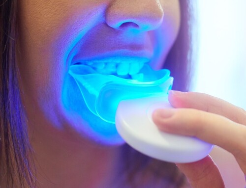 Top 3 Reasons Why You Should Get A Teeth Whitening Kit