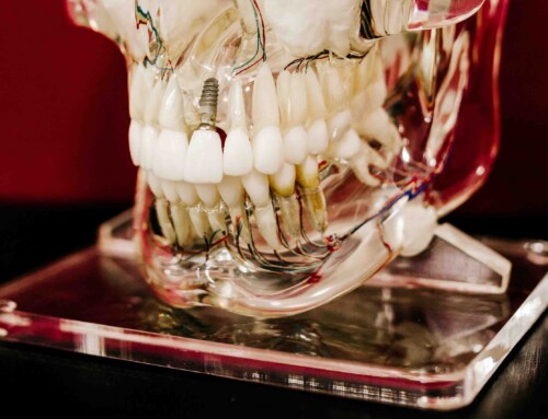 Follow These Aftercare Tips To Increase The Lifespan Of Your Dental Bridge