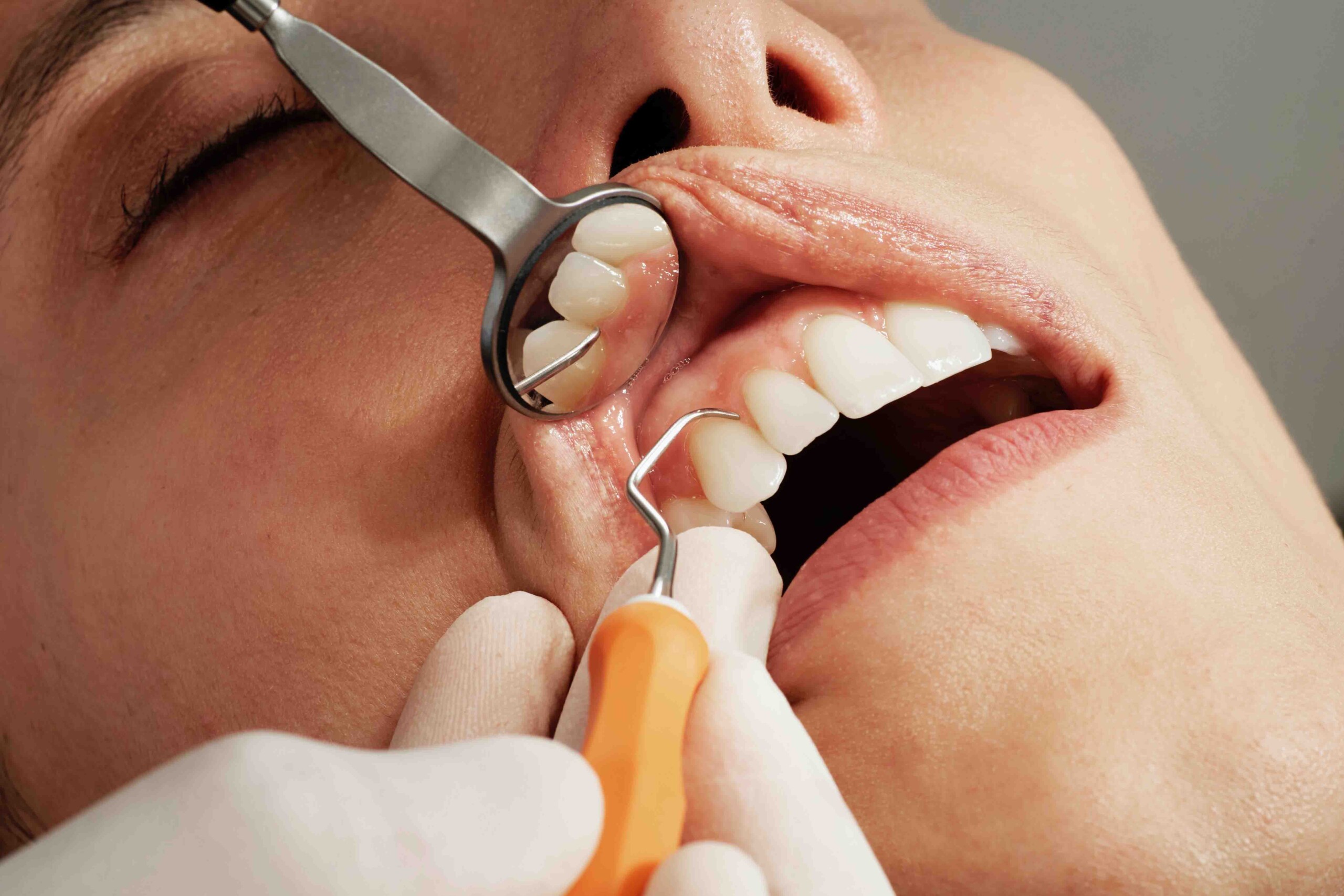 Common Types of Cosmetic Dentistry Procedures - District Dentistry