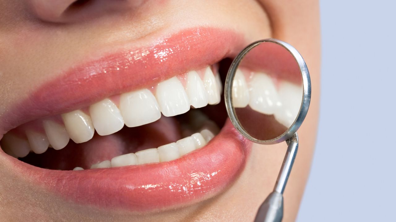 Tooth Bonding and Cosmetic Fixes - Dentists in Burlington, NC