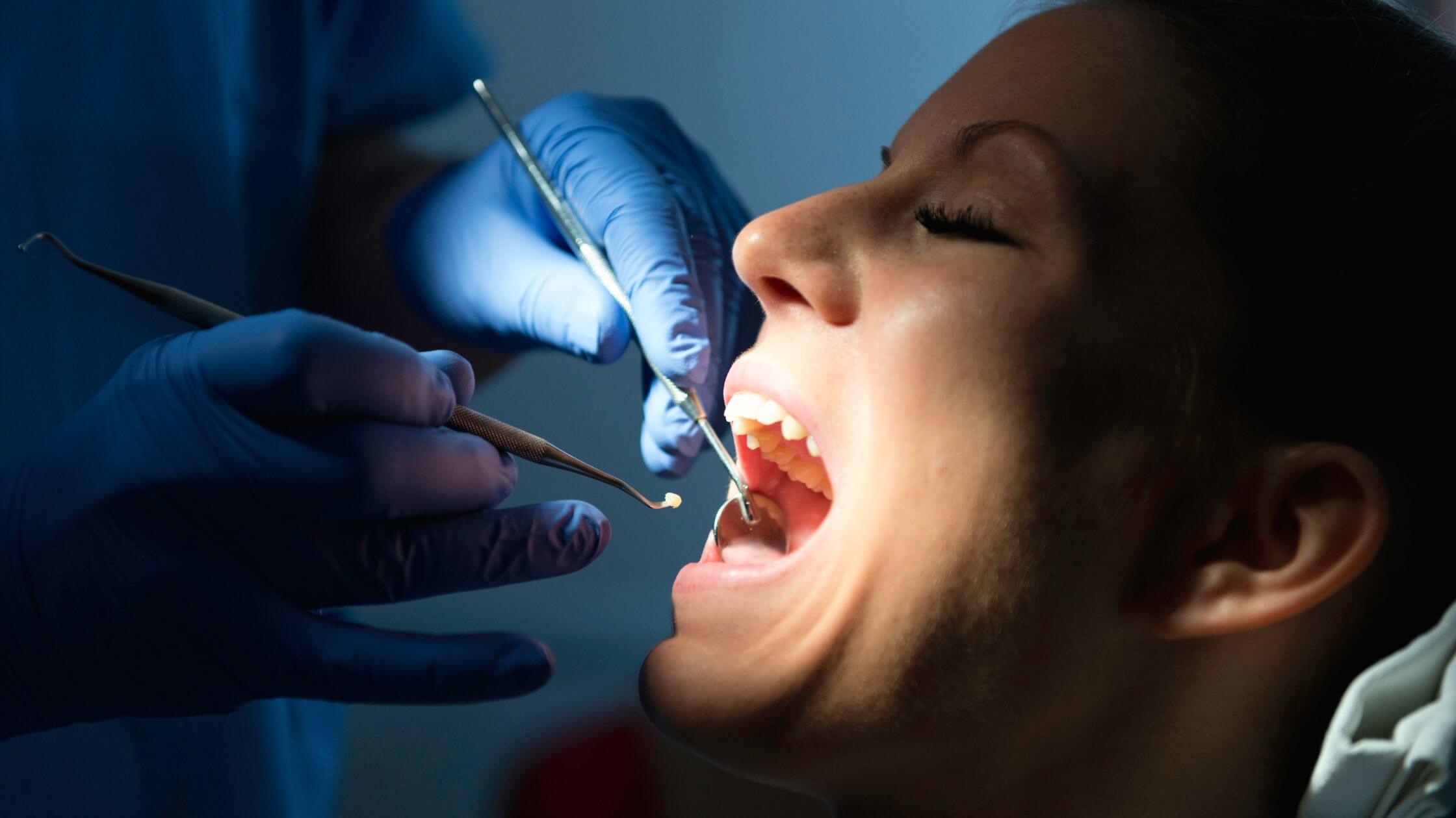 The Dental Filling Process and Types of Fillings - District Dentistry Charlotte