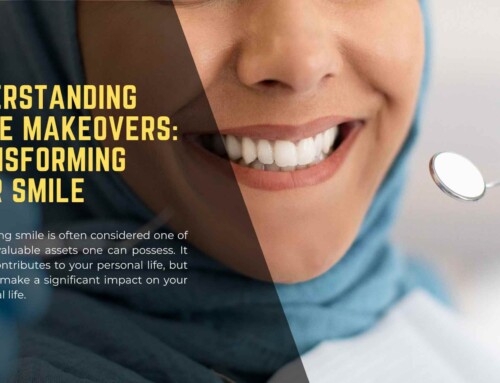Smile Makeovers: The Role of Veneers and Teeth Whitening