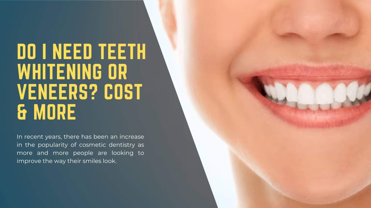 Teeth Whitening Or Veneers? Cost & More District Dental NC