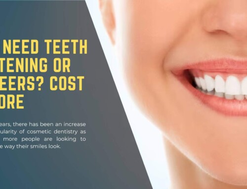 Do I Need Teeth Whitening Or Veneers? Cost & More
