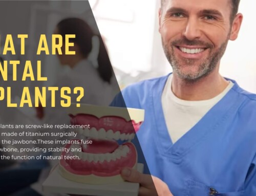 How To Know If You Need Dental Implants Or Veneers?