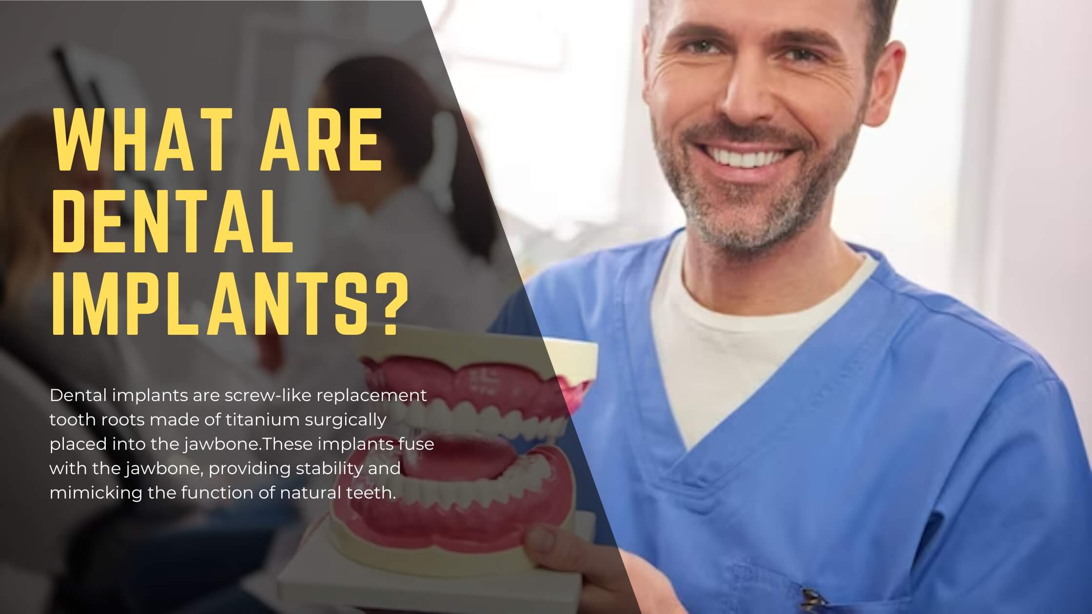 Do You Need Dental Implants Or Veneers - District Dentistry Charlotte